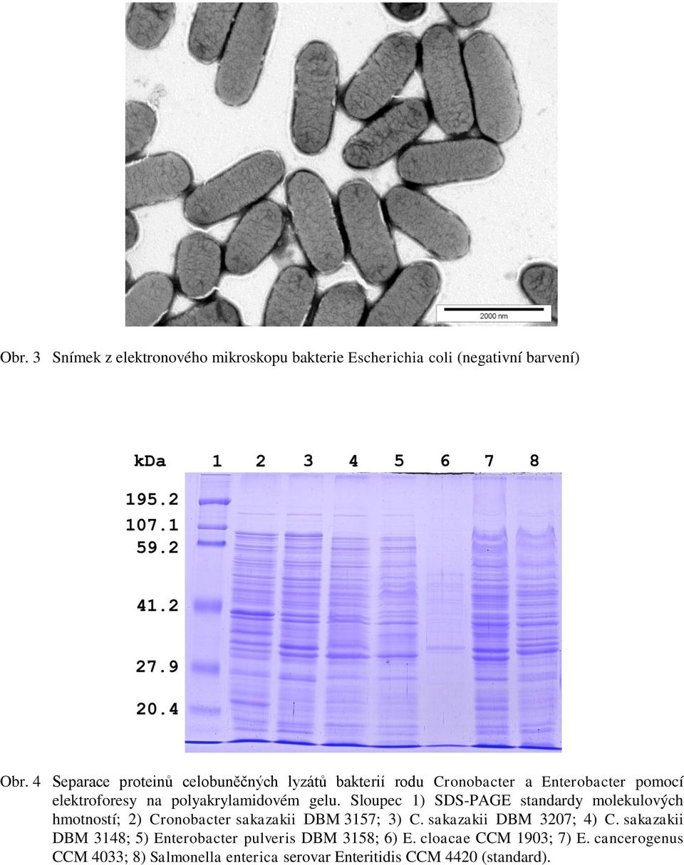 Sloupec 1) SDS-PAGE standardy molekulových hmotností; 2) Cronobacter sakazakii DBM 3157; 3) C. sakazakii DBM 3207; 4) C.