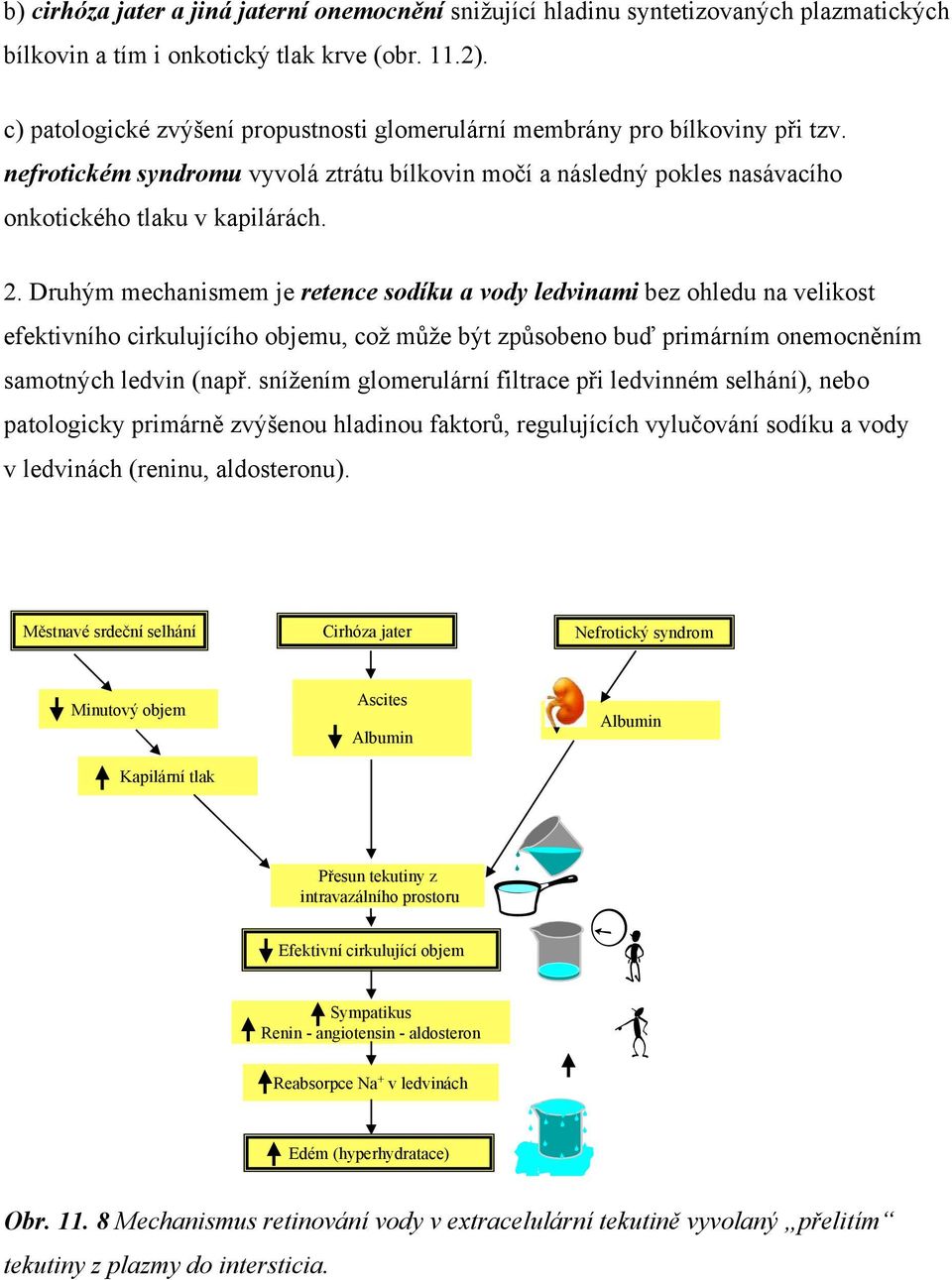 Druhým mechanismem je retence sodíku a vody ledvinami bez ohledu na velikost efektivního cirkulujícího objemu, což může být způsobeno buď primárním onemocněním samotných ledvin (např.