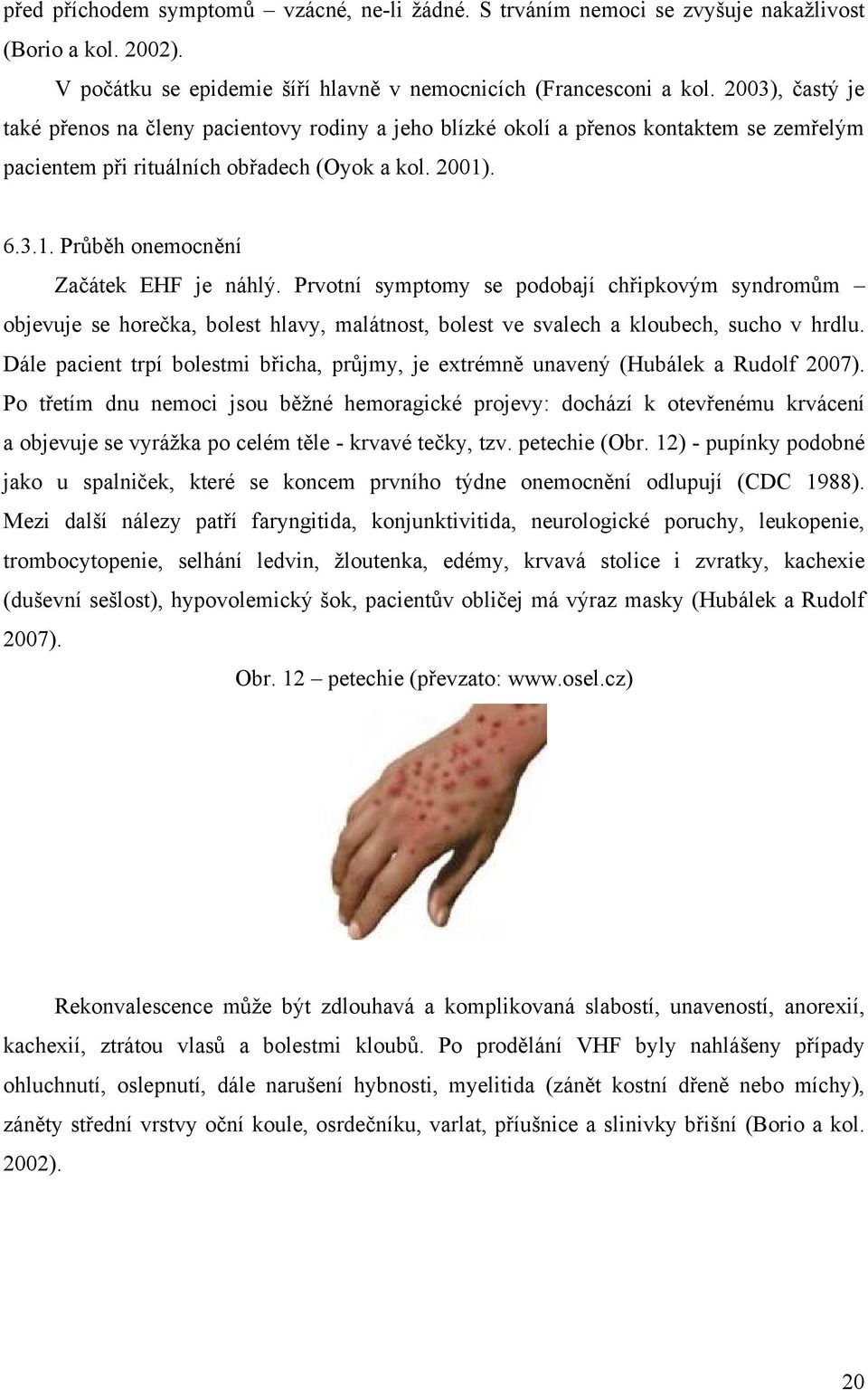 Prvotní symptomy se podobají chřipkovým syndromům objevuje se horečka, bolest hlavy, malátnost, bolest ve svalech a kloubech, sucho v hrdlu.