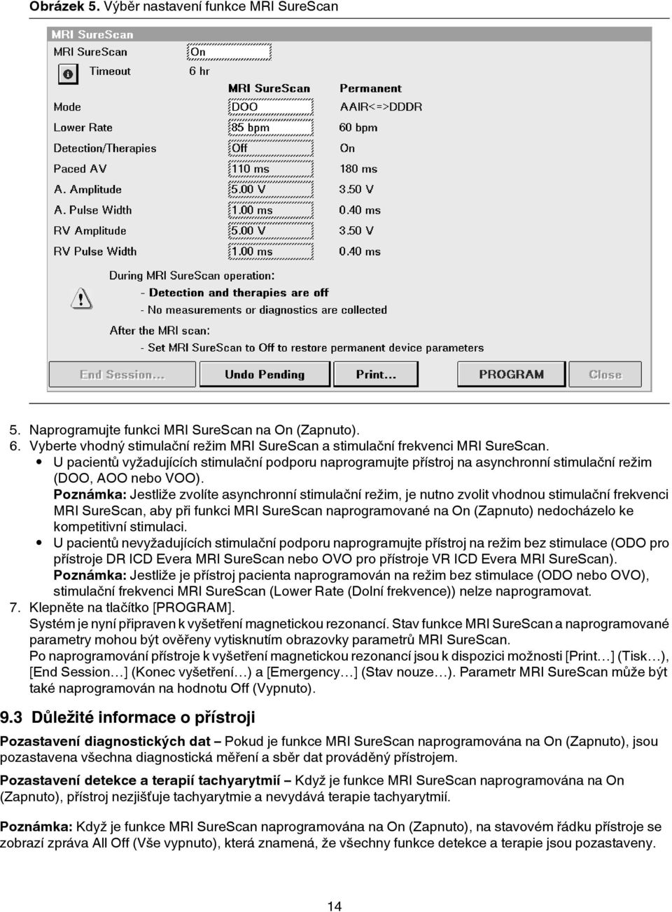 Poznámka: Jestliže zvolíte asynchronní stimulační režim, je nutno zvolit vhodnou stimulační frekvenci MRI SureScan, aby při funkci MRI SureScan naprogramované na On (Zapnuto) nedocházelo ke