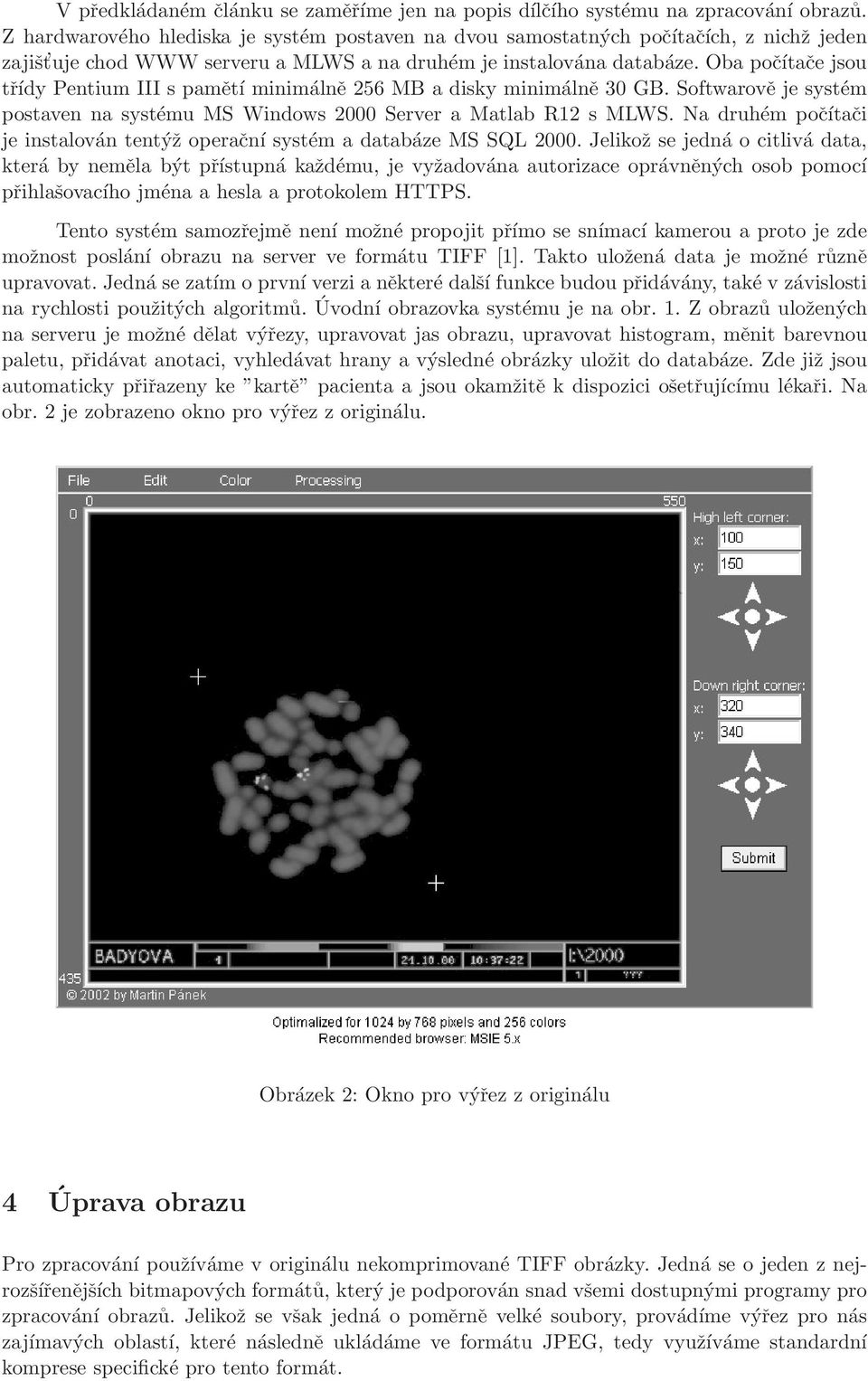 Oba počítače jsou třídy Pentium III s pamětí minimálně 256 MB a disky minimálně 3 GB. Softwarově je systém postaven na systému MS Windows Server a Matlab R12 s MLWS.