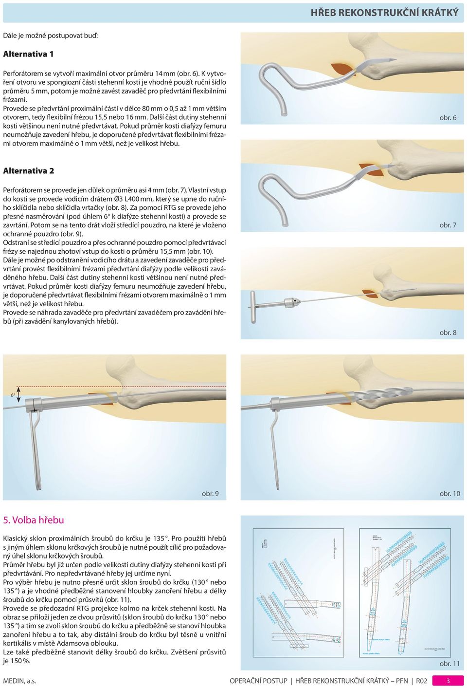 Provede se předvrtání proximální části v délce 80 mm o 0,5 až 1 mm větším otvorem, tedy flexibilní frézou 15,5 nebo 16 mm. Další část dutiny stehenní kosti většinou není nutné předvrtávat.