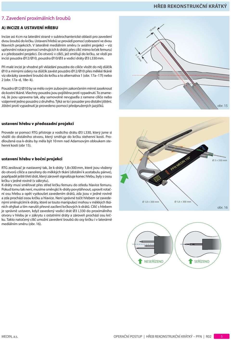 V laterálně mediálním směru (v axiální projekci viz upřesnění rotace pomocí směrujících k-drátů přes cílič mimo krček femuru) a v předozadní projekci.