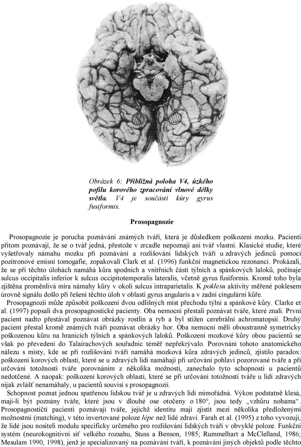 Klasické studie, které vyšetřovaly námahu mozku při poznávání a rozlišování lidských tváří u zdravých jedinců pomocí pozitronové emisní tomogafie, zopakovali Clark et al.