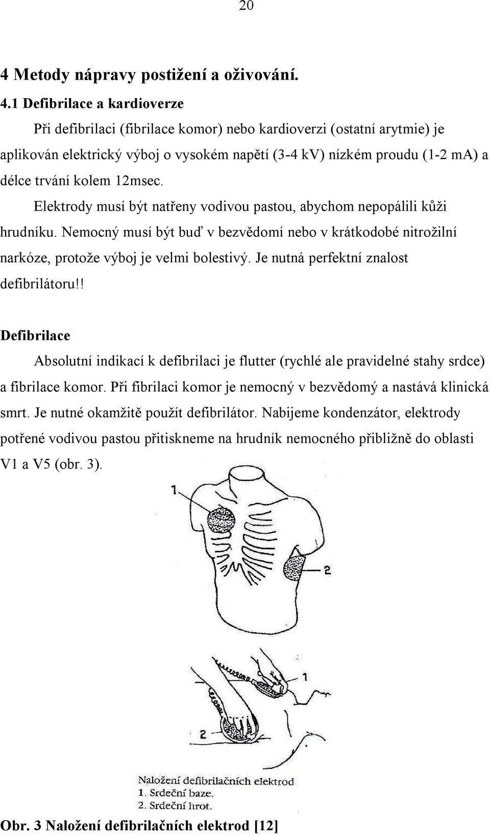 Nemocný musí být buď v bezvědomí nebo v krátkodobé nitrožilní narkóze, protože výboj je velmi bolestivý. Je nutná perfektní znalost defibrilátoru!