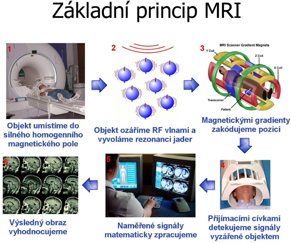 MRI