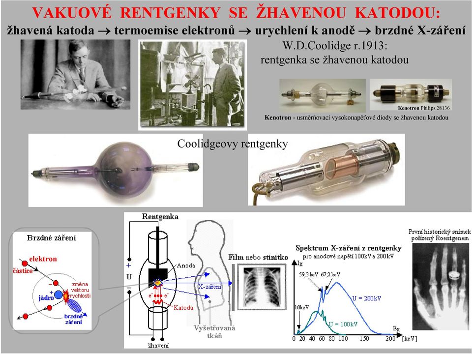 1913: rentgenka se žhavenou katodou Kenotron Philips 28136 Kenotron -