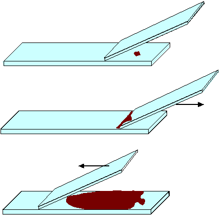 Závěr (nehodící se škrtněte): V preparátu pozorujeme jaderné/bezjaderné savčí erytrocyty oválného/kruhovitého tvaru se světlejším/tmavším středem.