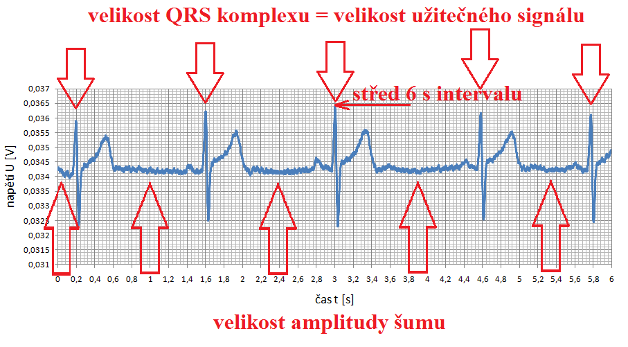 Hornovým postupem vypočítáme průměrnou velikost amplitudy užitečného signálu a amplitudy šumu. Metodou SNR (signal to noise ratio) vypočítáme kvalitu EKG záznamů.