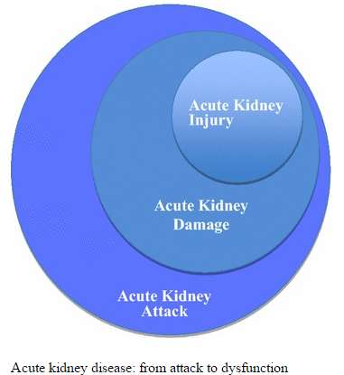 Akutní poškození ledvin AKA Acute kidney attack riziko AKI nebo dysfunkce ledvin např. v sepsi, velkých chirurg.