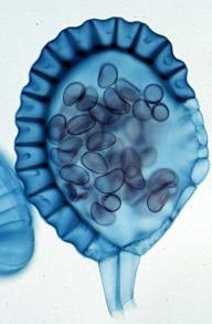 Sporangia leptosporangiátní - tenkostěnná, z jediné epidermální buňky jednovrstevná stěna řada buněk se ztlustlou stěnou prstenec (annulus)