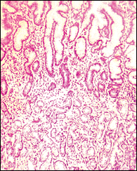 Toxiny v ANS STRES GLUTEN KOVY ALERGENY pyly prachové částice srst plísně potraviny OČKOVÁNÍ DROGY LÉKY NEUROINFEKCE MIKROBIÁLNÍ TOXINY