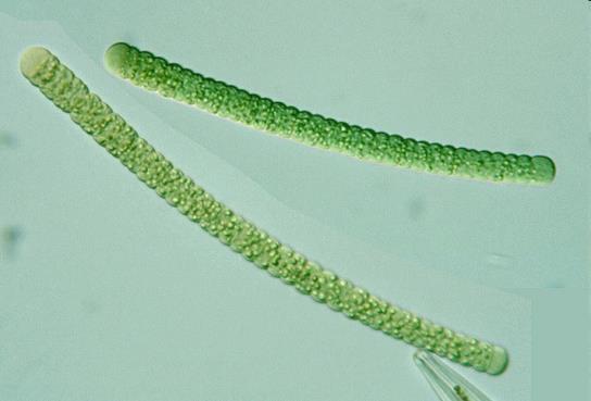 HROZBA 5 Toxicita sinic AOM obsahují řadu toxických látek, tzv. sinicové toxiny (např. mikrocystin, nodularin) Nodularia spumigena Microcystis sp. http://protist.i.hosei.ac.jp/pdb3/pcd4088/html s/29.