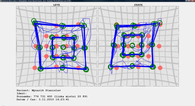 případového usuzování Návrh diagnózy + nejpodobnější příklady > pro lékaře + znalostní systém obsaženy znalosti expertů => doplnění / upřesnění návrhu diagnózy Léčebné