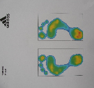 Obr.č.28 Footscan (www.rsscan.com) Obr.č.29 Plantogram (pořízeno z vlastního měření - tisk) Otisky můžeme hodnotit podle různých kriterií a metod jak je popsané v následující kapitole. 5.