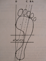 Obr.č.27 Hodnocení plantogramu modifikovanou metodou segmentů(purgarič, 1994). Hodnocení podle Godunova ( Brotzmanová, 1990) a (Purgarič, 1994). Jde o kvalitativní metodu.