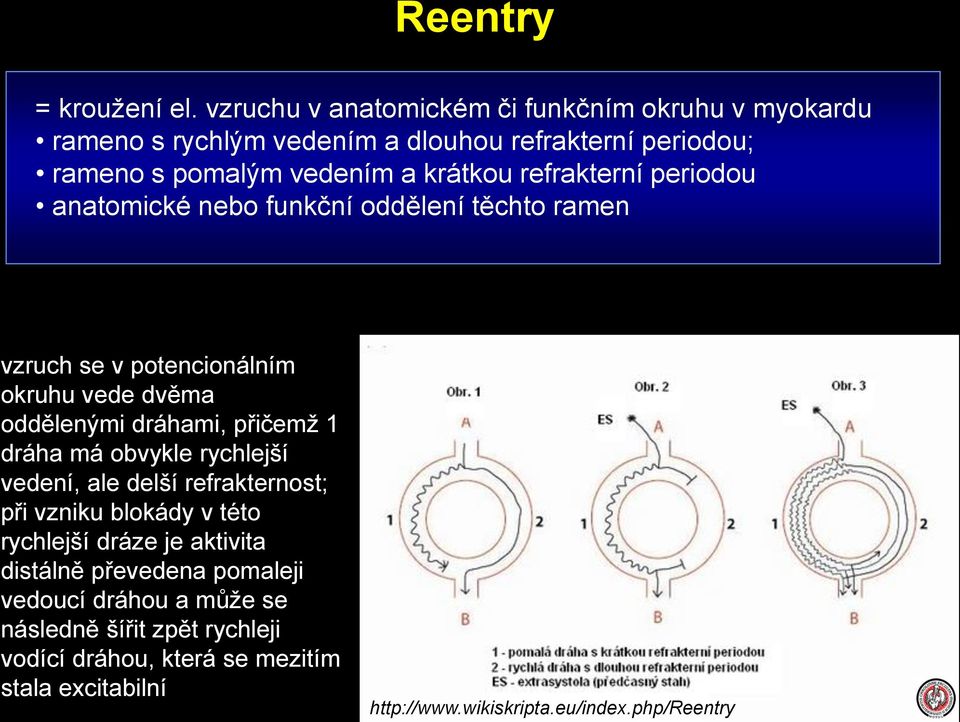 refrakterní periodou anatomické nebo funkční oddělení těchto ramen vzruch se v potencionálním okruhu vede dvěma oddělenými dráhami, přičemž 1 dráha