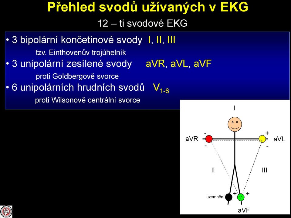 Einthovenův trojúhelník 3 unipolární zesílené svody proti Goldbergově