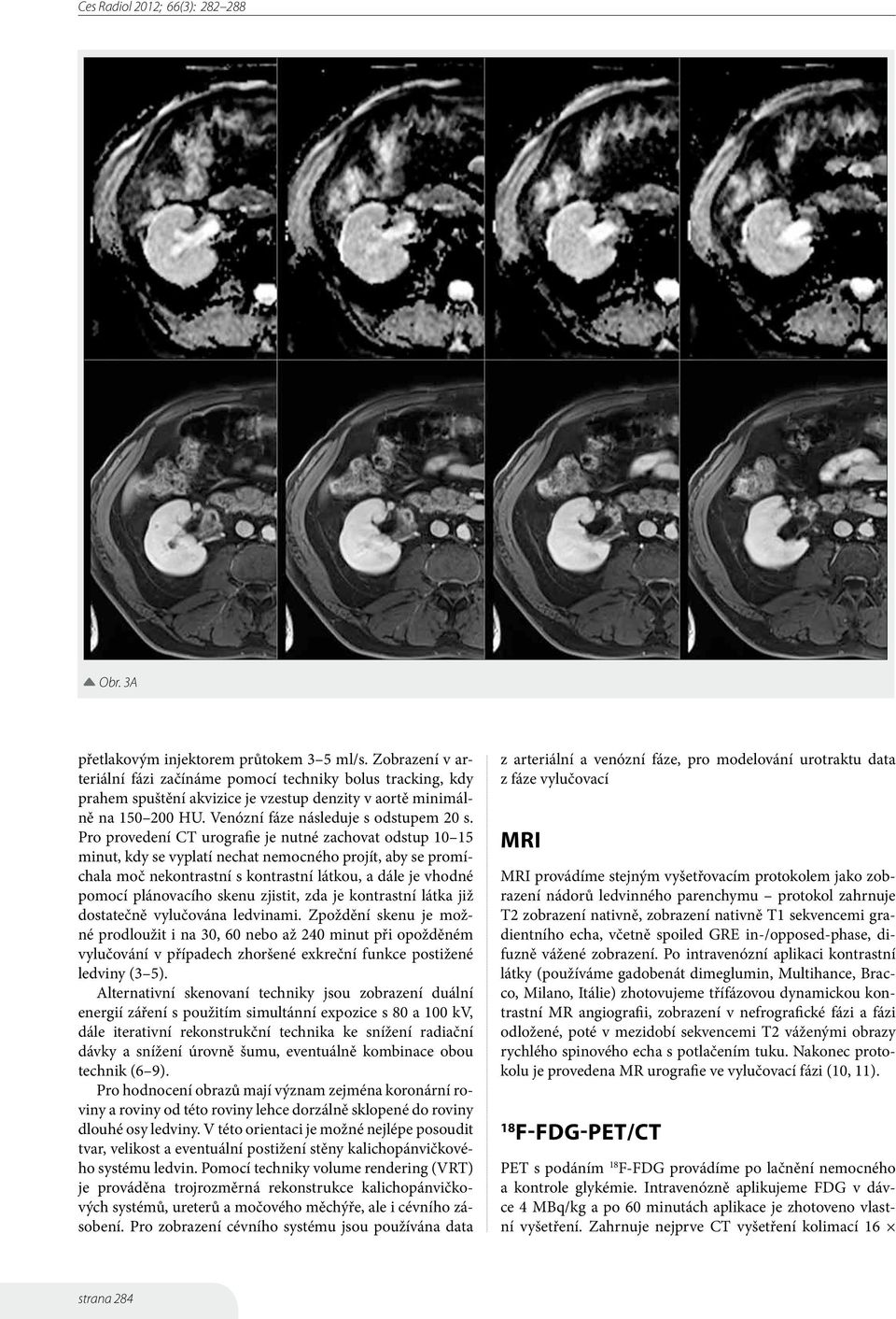 Pro provedení CT urografie je nutné zachovat odstup 10 15 minut, kdy se vyplatí nechat nemocného projít, aby se promíchala moč nekontrastní s kontrastní látkou, a dále je vhodné pomocí plánovacího