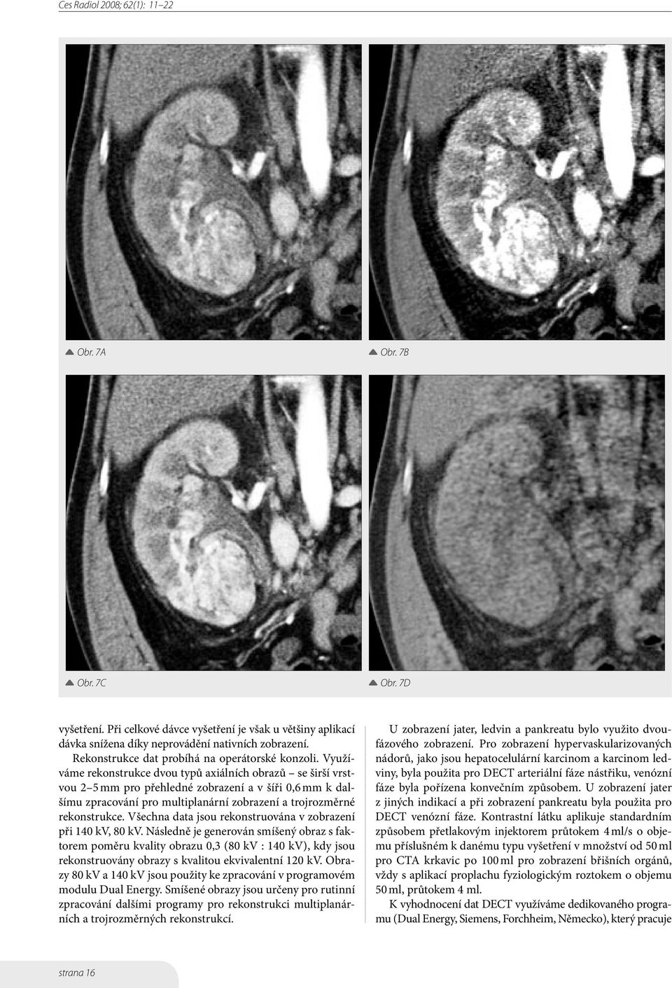Všechna data jsou rekonstruována v zobrazení při 140 kv, 80 kv.