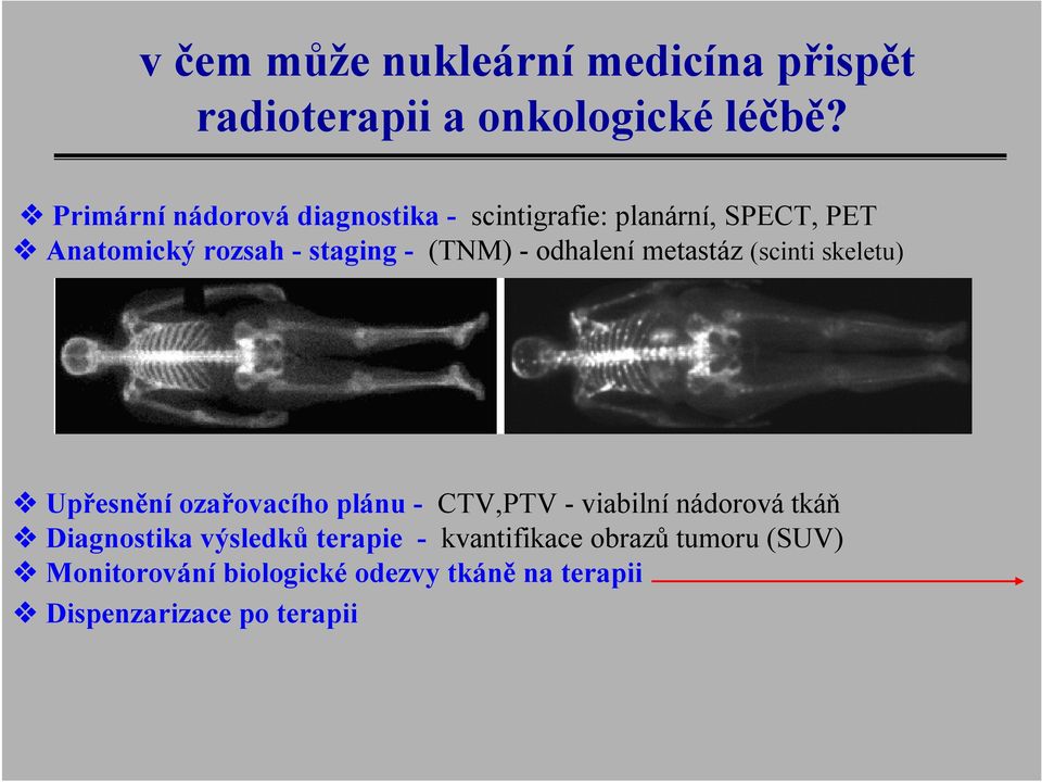 - odhalení metastáz (scinti skeletu) Upřesnění ozařovacího plánu - CTV,PTV - viabilní nádorová tkáň
