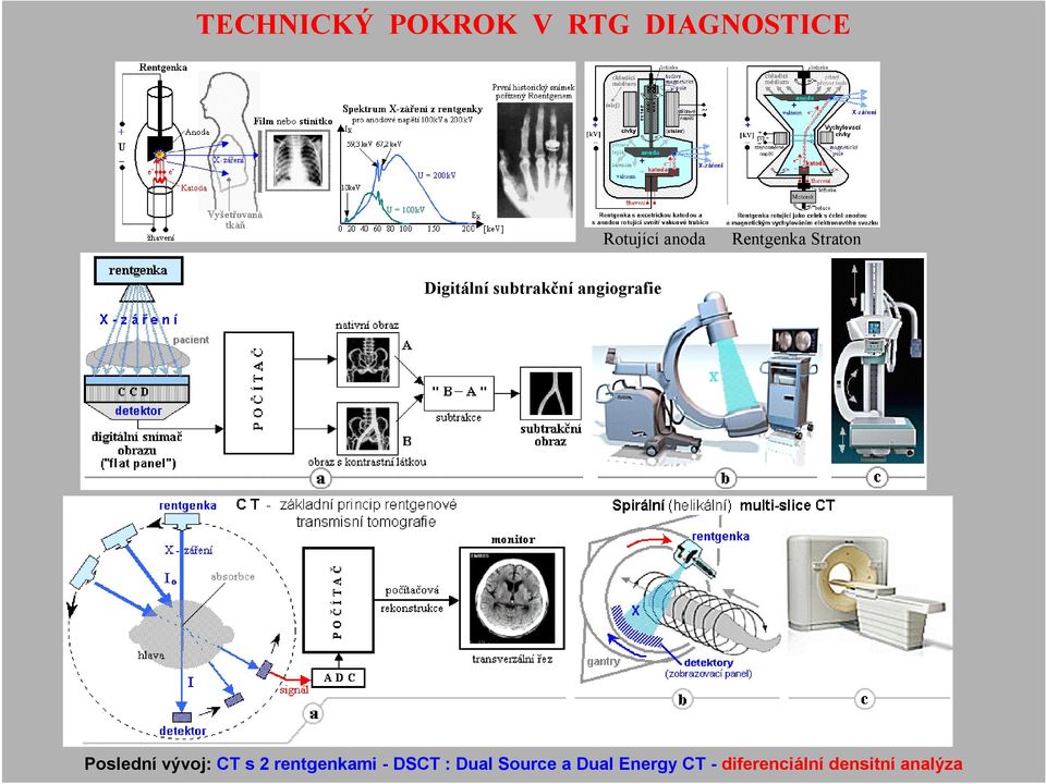 Poslední vývoj: CT s 2 rentgenkami - DSCT : Dual