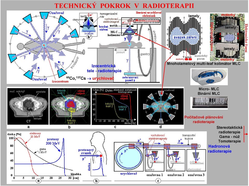 Micro- MLC Binární MLC Počítačové plánování radioterapie