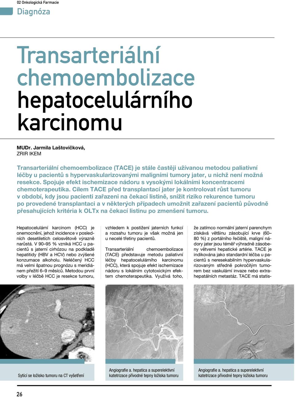 možná resekce. Spojuje efekt ischemizace nádoru s vysokými lokálními koncentracemi chemoterapeutika.