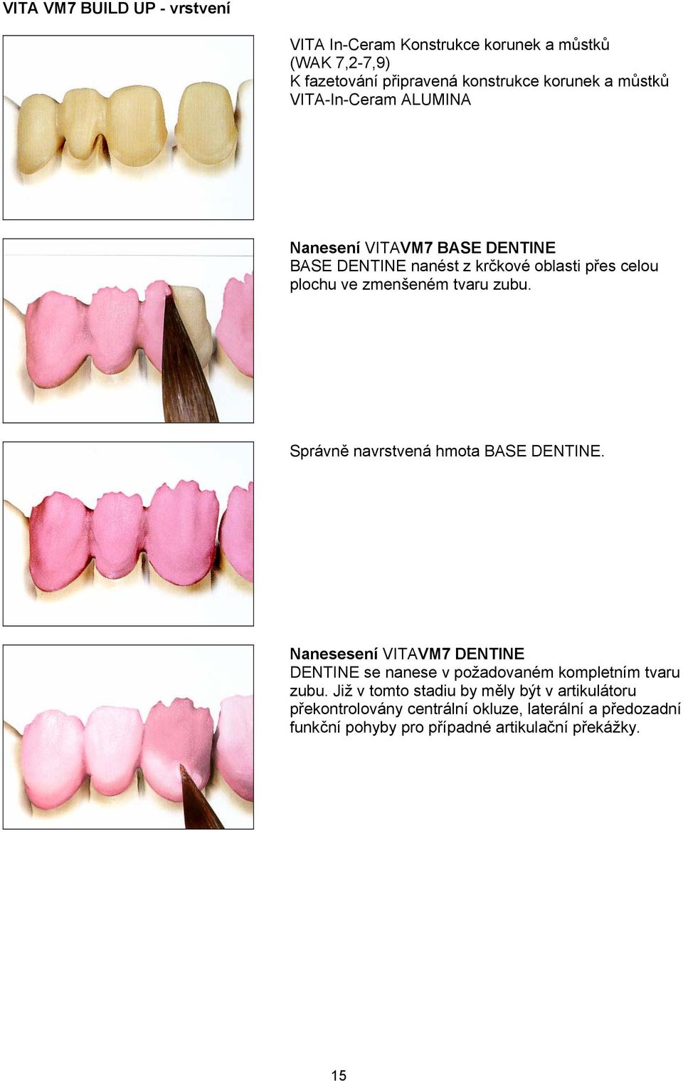Správně navrstvená hmota BASE DENTINE. Nanesesení VITAVM7 DENTINE DENTINE se nanese v požadovaném kompletním tvaru zubu.
