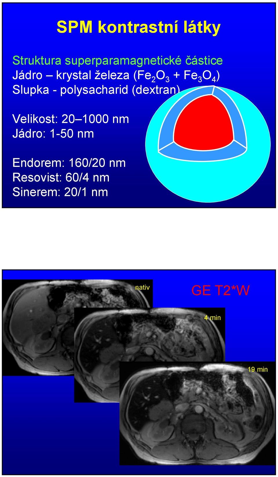 polysacharid (dextran) Velikost: 20 1000 nm Jádro: 1-50 nm