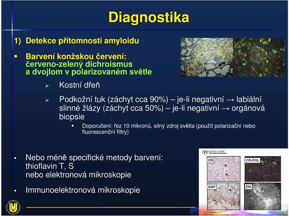 50%) je-li negativní orgánová biopsie Doporučení: řez 10 mikronů, silný zdroj světla (použít polarizační nebo