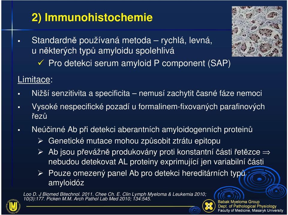 Genetické mutace mohou způsobit ztrátu epitopu Ab jsou převážně produkovány proti konstantní části řetězce nebudou detekovat AL proteiny exprimující jen variabilní části Pouze