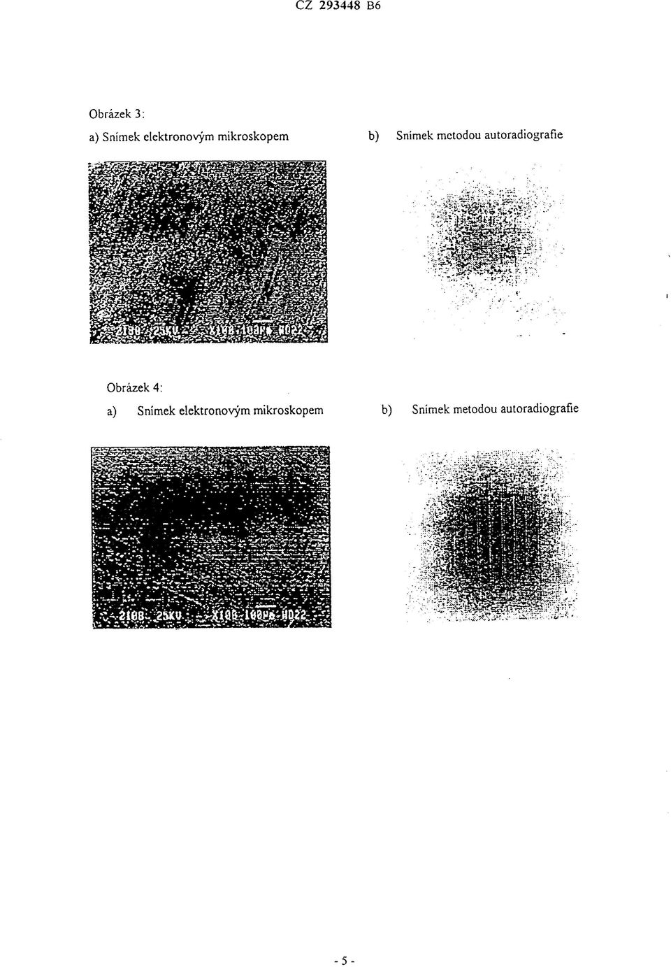 autoradiografie Obrázek 4: a) Snímek