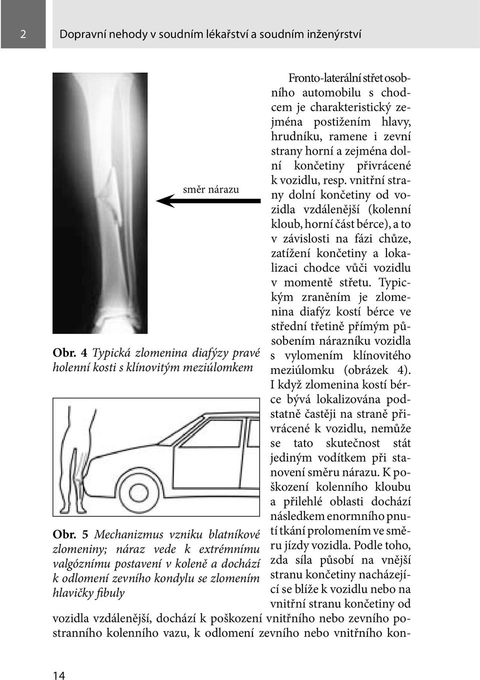 automobilu s chodcem je charakteristický zejména postižením hlavy, hrudníku, ramene i zevní strany horní a zejména dolní končetiny přivrácené k vozidlu, resp.