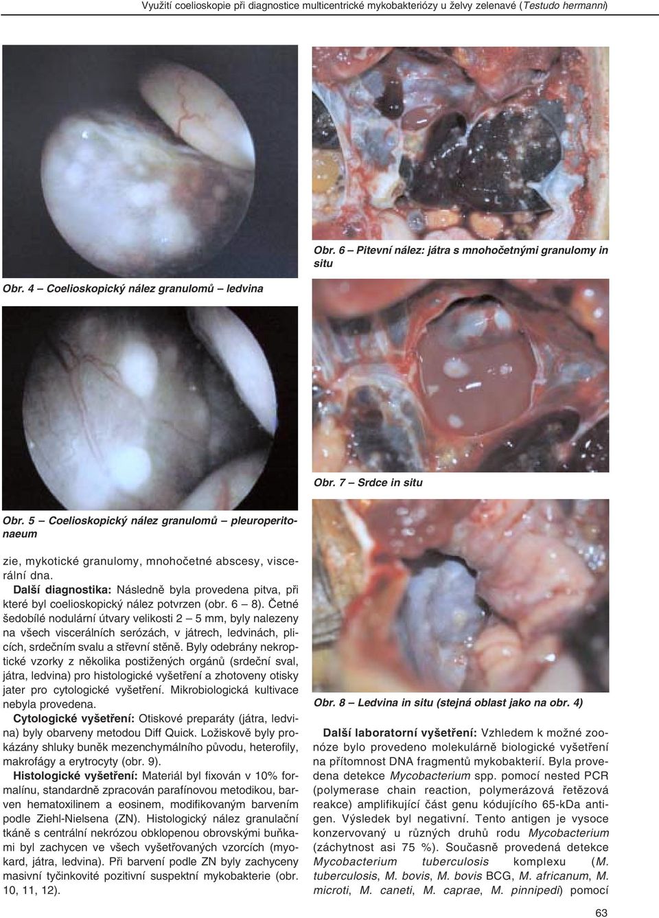 Další diagnostika: Následně byla provedena pitva, při které byl coelioskopický nález potvrzen (obr. 6 8).