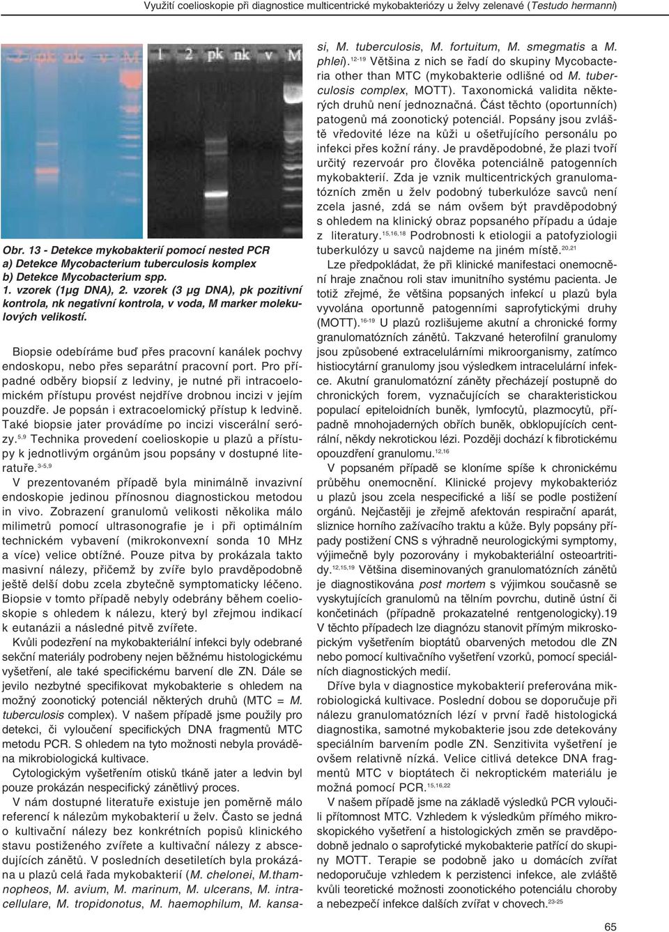 vzorek (3 µg DNA), pk pozitivní kontrola, nk negativní kontrola, v voda, M marker molekulových velikostí.