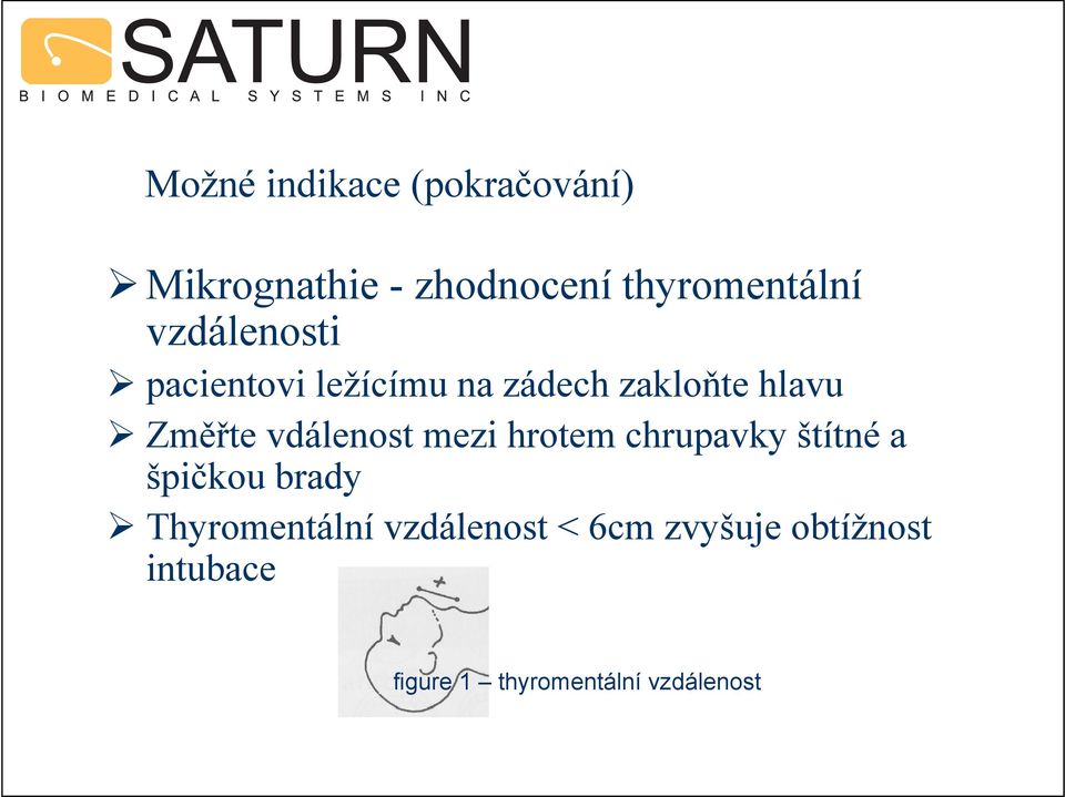 vdálenost mezi hrotem chrupavky štítné a špičkou brady Thyromentální