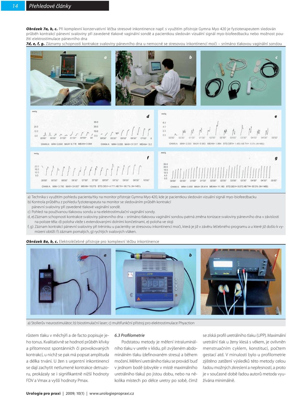 možnost použití elektrostimulace pánevního dna 7d, e, f, g.