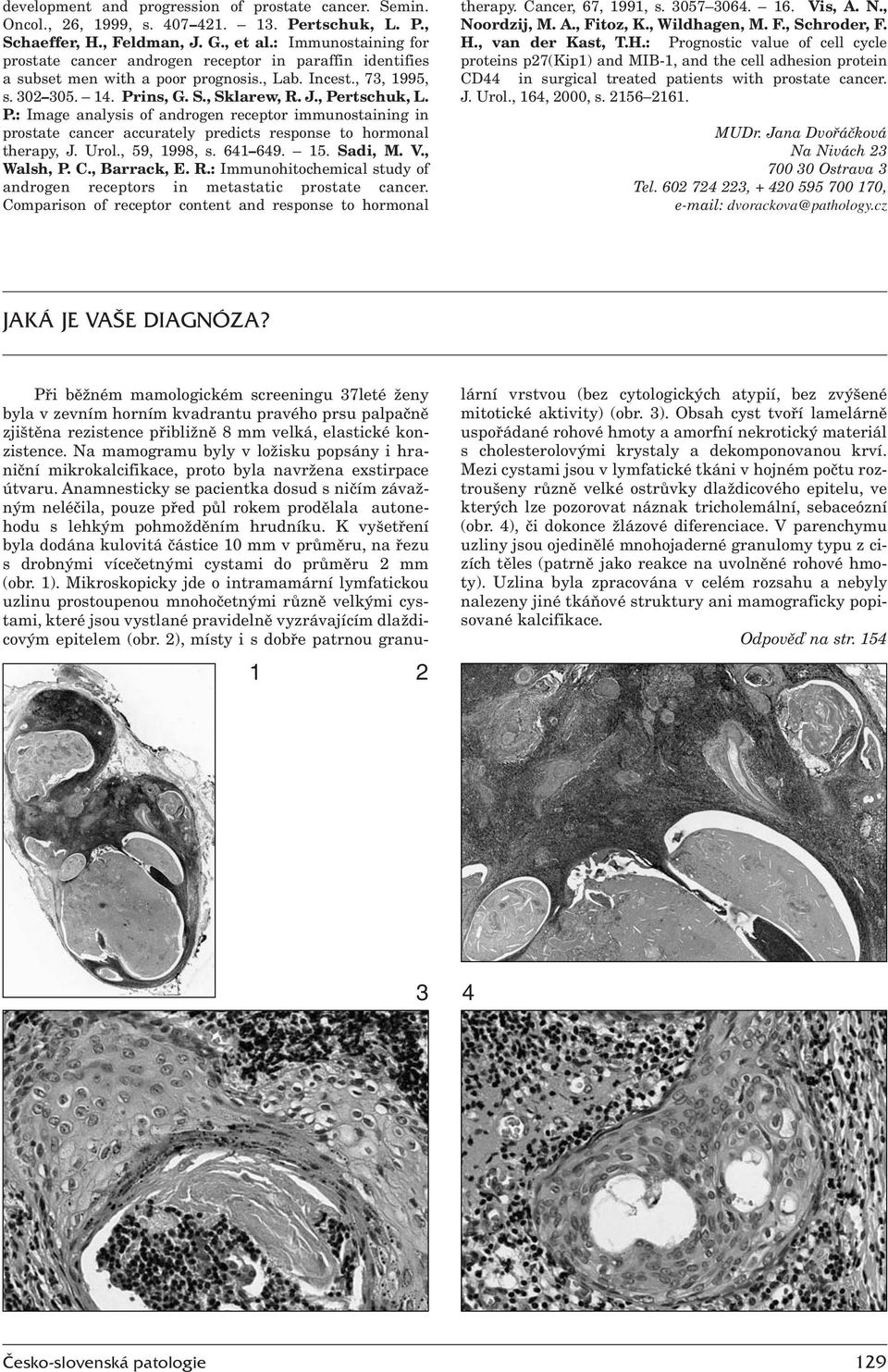 P.: Image analysis of androgen receptor immunostaining in prostate cancer accurately predicts response to hormonal therapy, J. Urol., 59, 1998, s. 641 649. 15. Sadi, M. V., Walsh, P. C., Barrack, E.