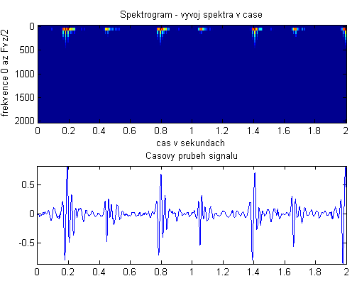 4.3 Spektrogram Ve spektru, které je vypočítané pomocí FFT, nedokážeme časově lokalizovat jednotlivé spektrální složky, proto pro sledování vývoje frekvencí signálu v čase použijeme časově-frekvenční