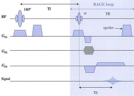 Obrázek 16: Diagram pulsní sekvence IR turbo FLASH [8] Další metodou preparace je aplikace dvou 90 pulsů P 1 a P 2 (viz obrázek č. 17).