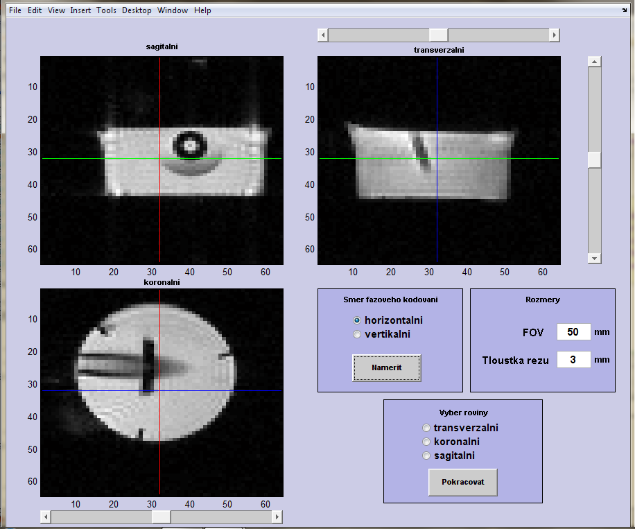 Po zobrazení naměřených obrazů ze tří rovin se objeví tři posuvníky, kterými lze nastavit potřebný řez obrazem ve všech třech rovinách.