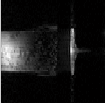 komůrky dialyzátoru z oblasti o velikosti 6 pixelů. Oblast zájmu pro druhou metodu proměnných sklápěcích úhlů pro výběr AIF tvořil větší počet pixelů, který sahal přes celou výšku komůrky.