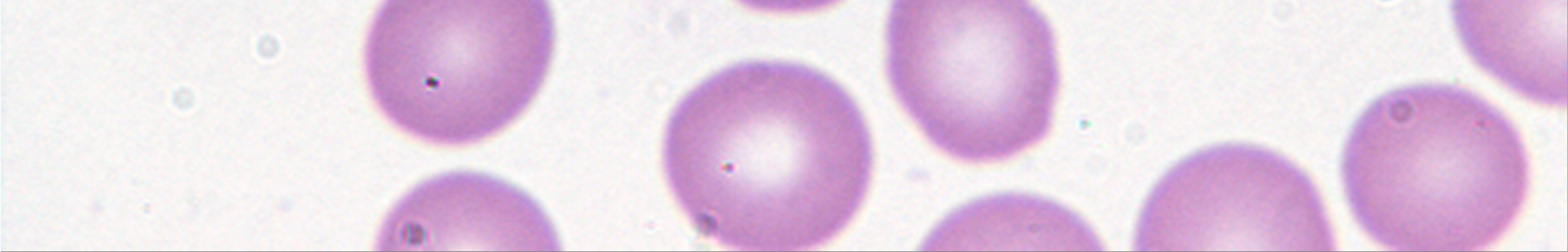 Obr. 1 Krevní nátěr - Krevní monocyt (Mo). Panoptické barvení, zvětšení 1000x.