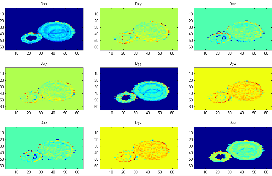 Obr. 1.4: Vypočtené DWI obrazy, které odpovídají jednotlivým prvkům v tenzoru D. Výsledný DTI obraz byl počítán v programu Matlab za použití vztahu (1.4). Obr. 1.5 znázorňuje měřený vzorek kopru s cibulí v transverzálním řezu metodou DTI.