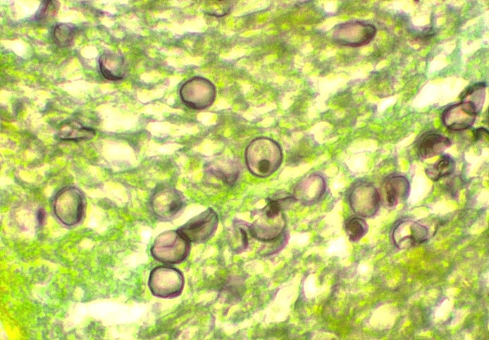 Trichomonas vaginalis Pneumocystis carinii Sporný organismus V ne kterých systémech se r adí mezi prvoky, v jiných mezi kvasinky. Kultivuje se na speciálních pu dách spíš jako kvasinka.