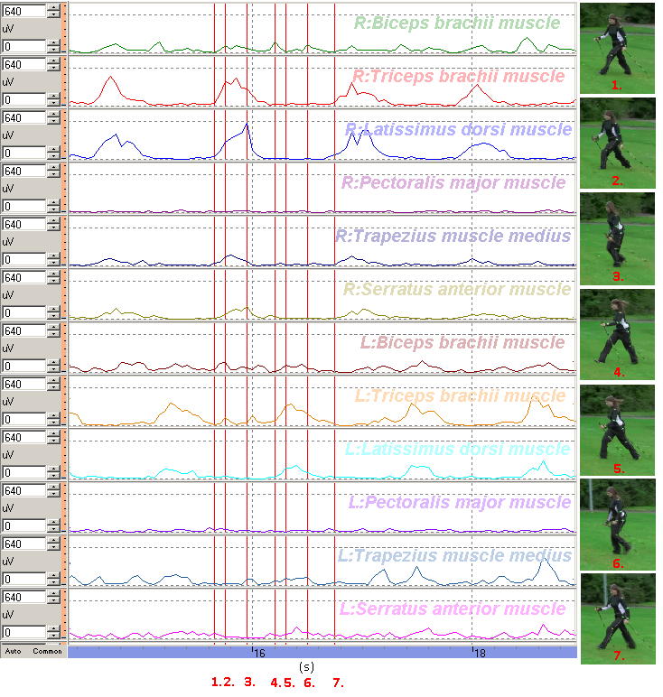 4 Výsledky 4.1 Intraindividuální analýza Graf č. 1 ukazuje záznam EMG křivky čtyř pohybových cyklů Nordic Walking do kopce u probanda č.