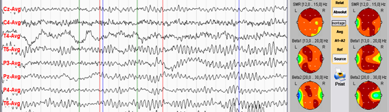 Obr. 5. 2. Grafické zobrazení měření druhého experimentu.