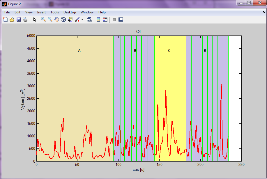 5.4.3 Výsledky z měření druhého experimentu Při měření experimentu, kdy pacient pomyslel na pohyb ruky, jakmile mu obsluha EEG dala signál, byly výsledky zpracovány také v prostředí Matlab.