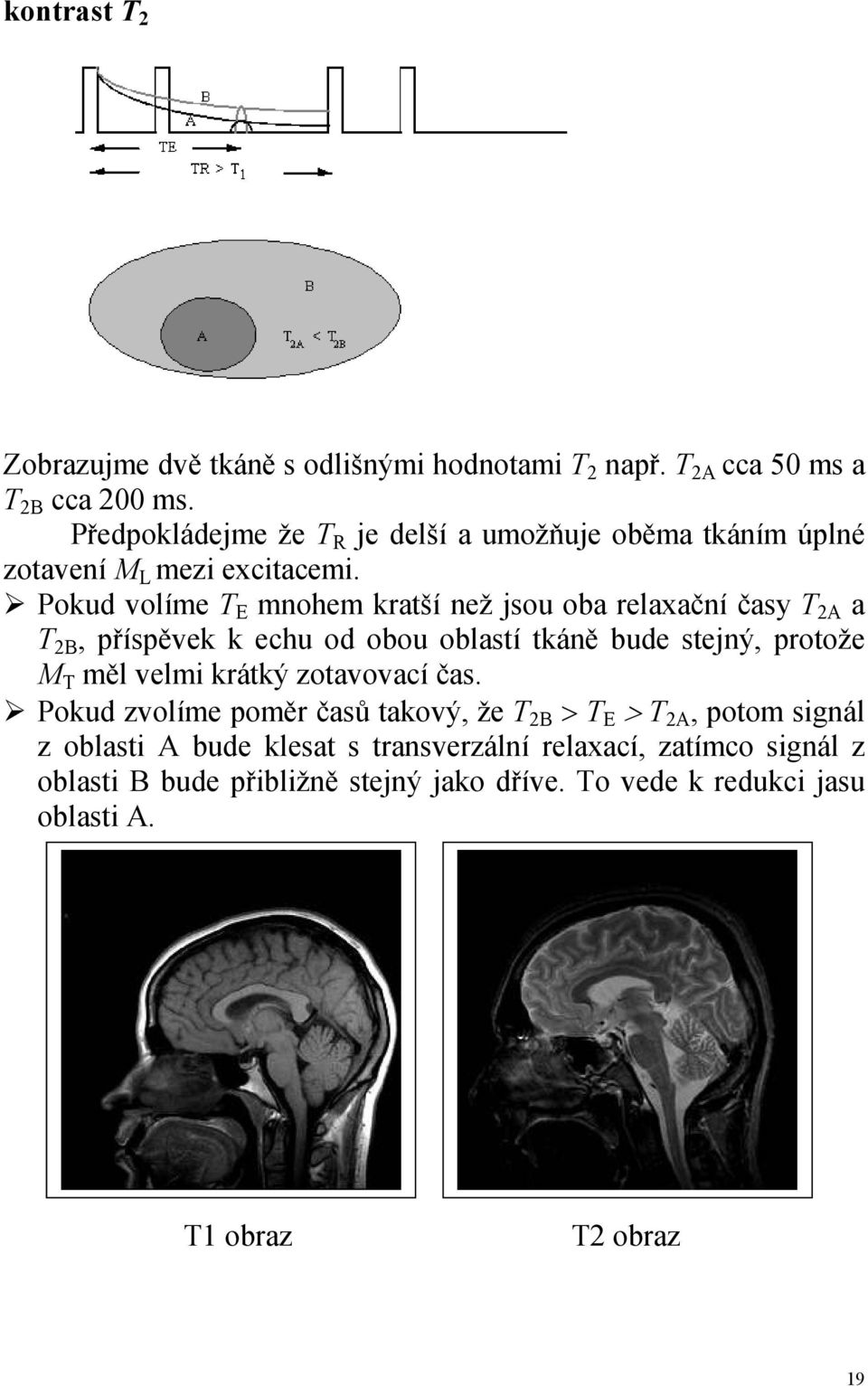 tkáně bude stejný, protože M T měl velmi krátký zotavovací čas Pokud zvolíme poměr časů takový, že T 2B > T E > T 2A, potom signál z oblasti A